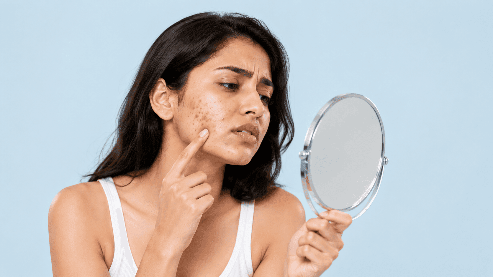 Woman examining acne pigmentation and dark spots on her face in a mirror