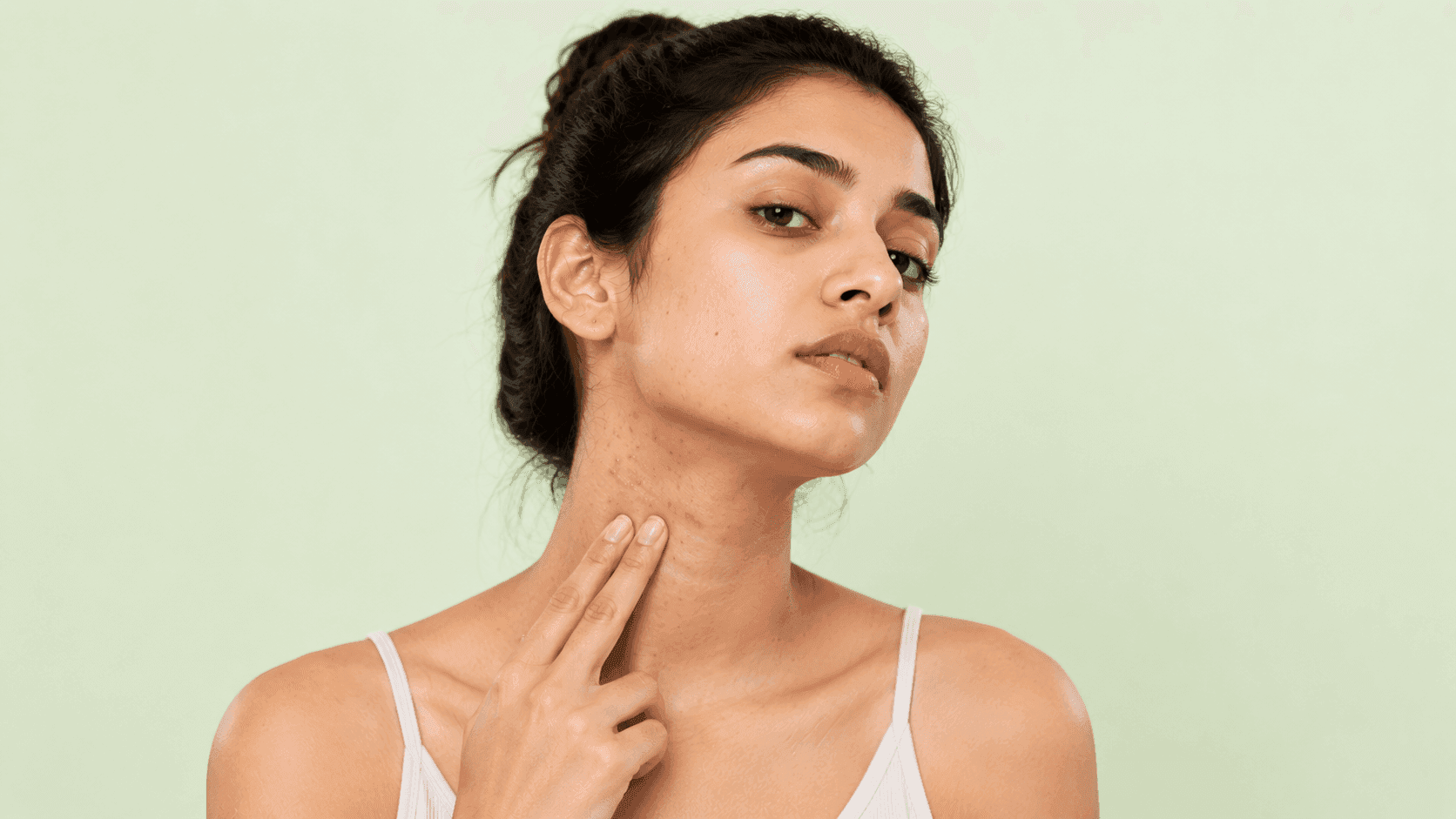 Close-up of neck acne showing inflamed pimples and skin irritation