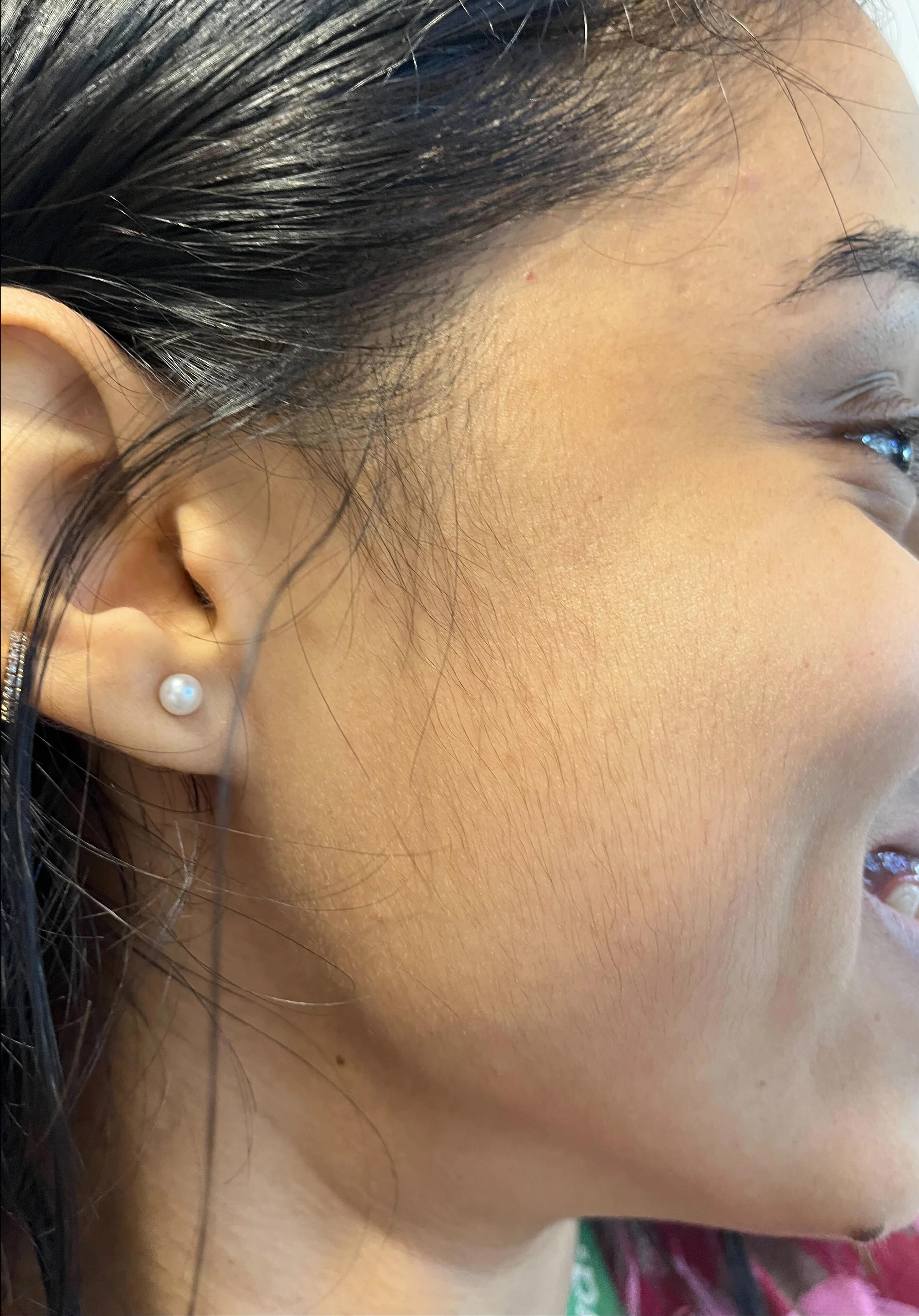 After treatment