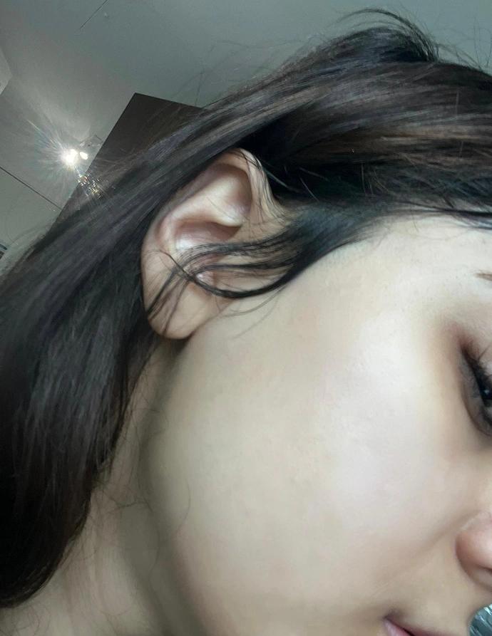 After treatment
