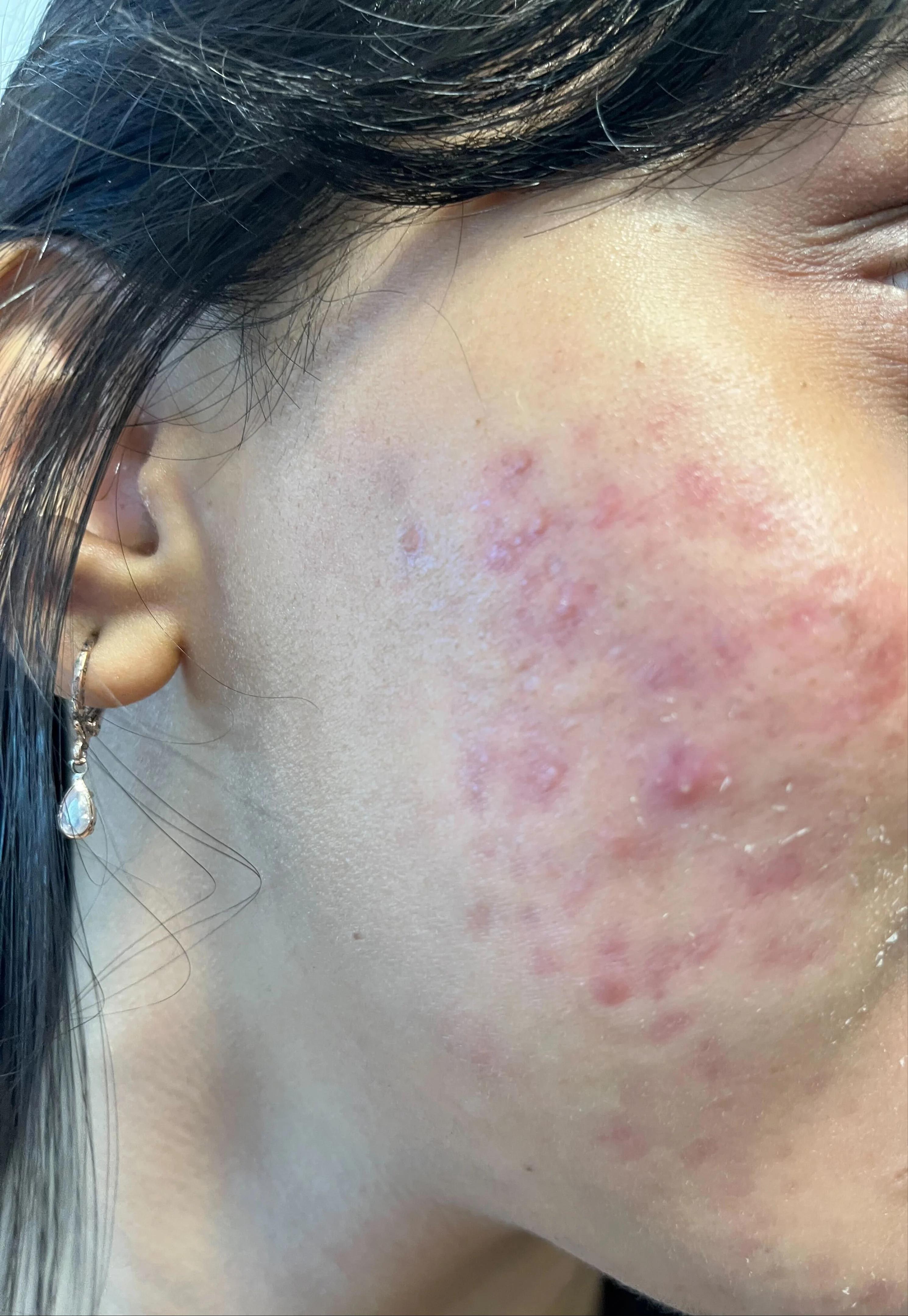 Before treatment