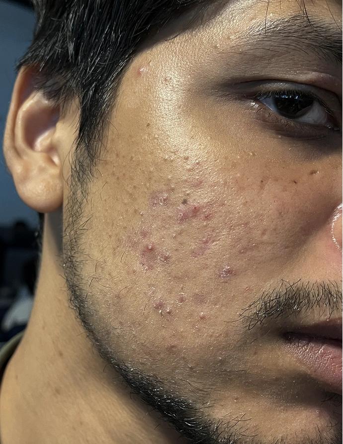 Before treatment