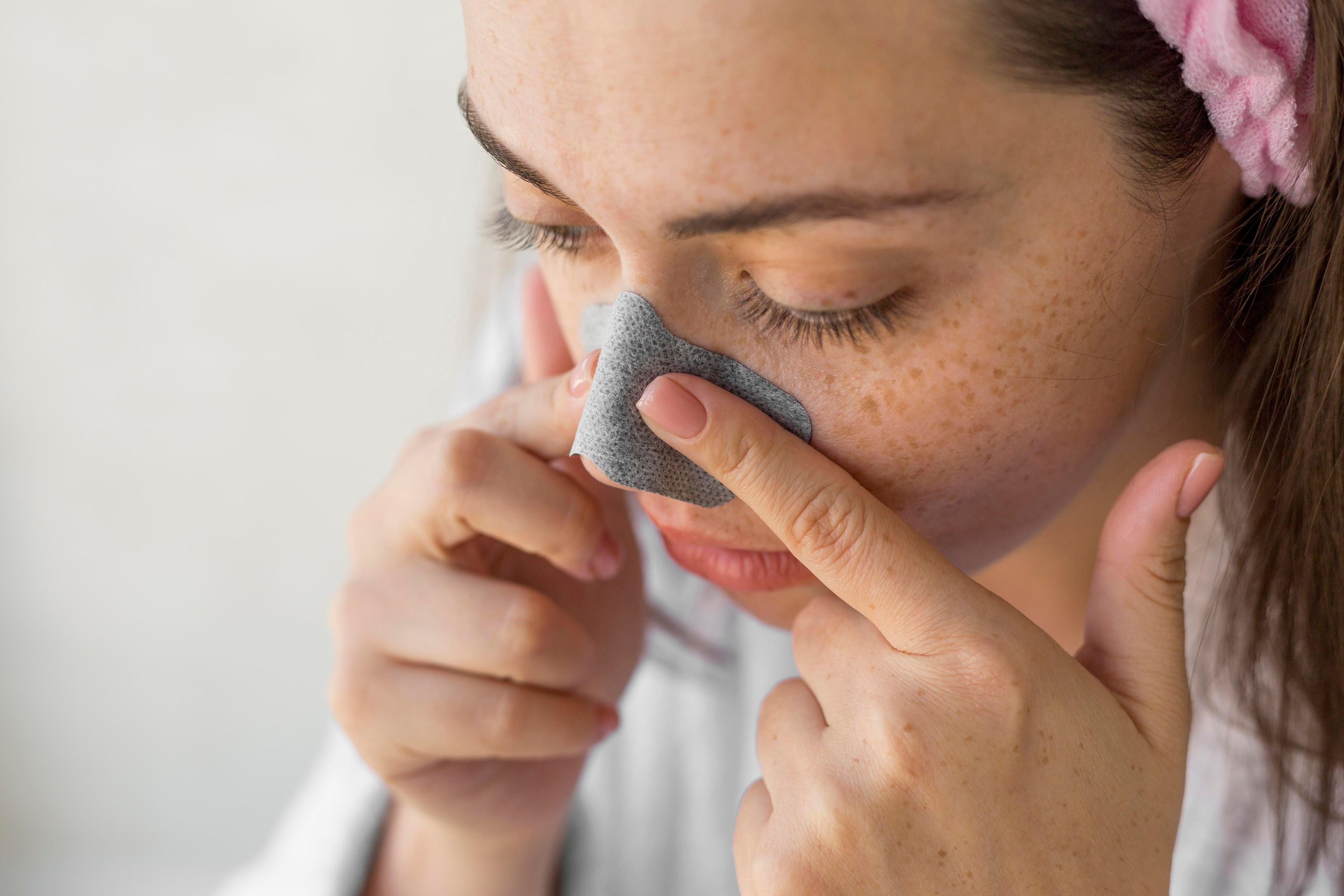 Preventing blackheads long-term