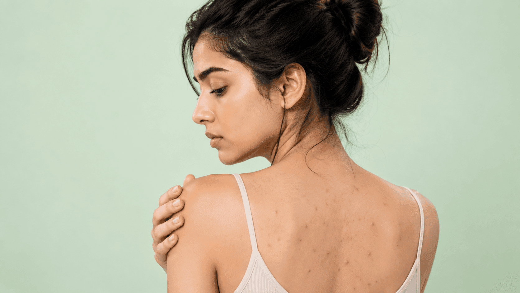 Hair products like shampoo, conditioner and hair oil contributing to back acne (bacne) on the skin