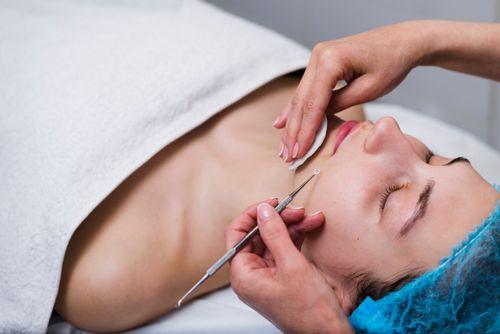 Blackhead Remover Tool: Which One Is Safe to Use?