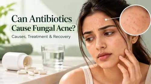 Can Antibiotics Cause Fungal Acne? Causes, Treatment & Recovery
