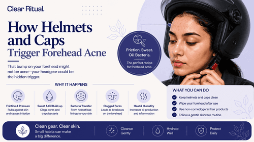 How Helmets and Caps Trigger Forehead Acne