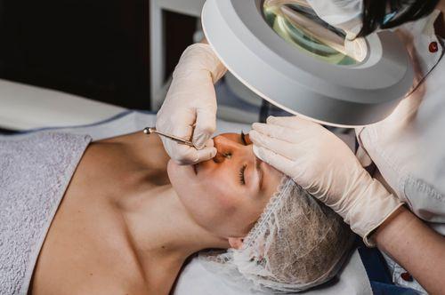 Professional Blackhead Extraction: What to Expect at a Clinic