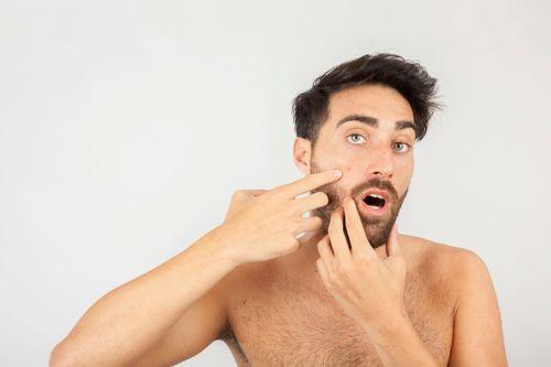 Sunscreen and Pimples: Can SPF Cause Breakouts?
