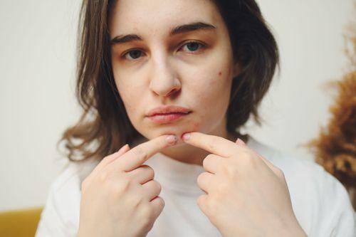 Ingredients That Can Worsen Fungal Acne